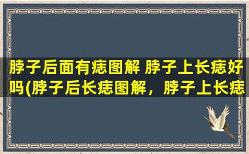 脖子后面有痣图解 脖子上长痣好吗(脖子后长痣图解，脖子上长痣该不该切除？)